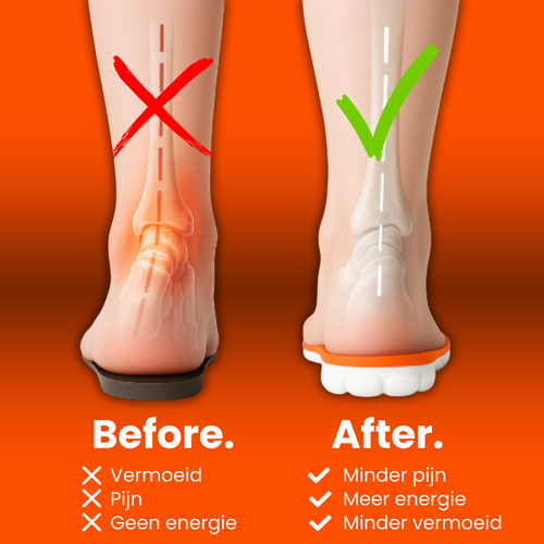 Solefy® - Massage inlegzolen