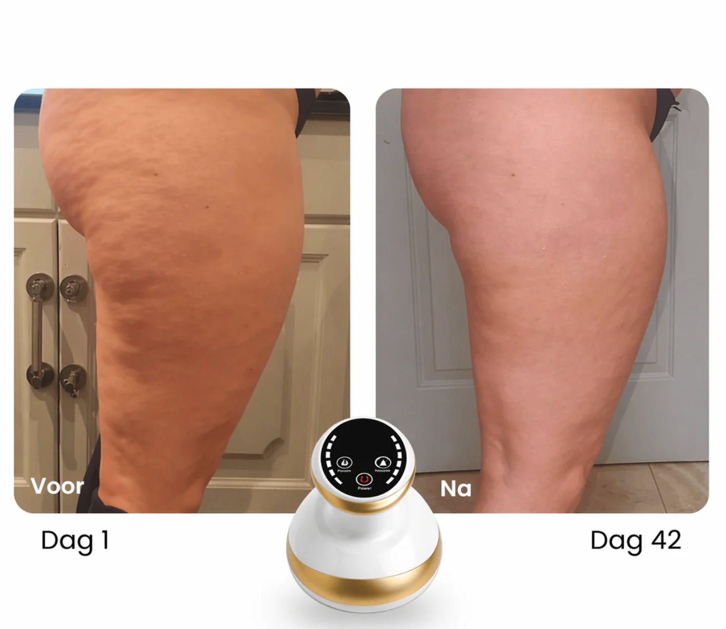 Luméa Sculpt™ - anti-cellulitis tool voor een gladdere huid en strakkere contouren
